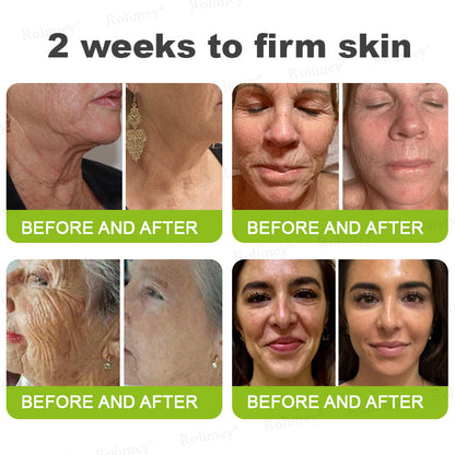 Rolimey® Botox & Vita-A Retinol Shot Wrinkle-Lift Tightening cream - Last Day Promotion 70% OFF