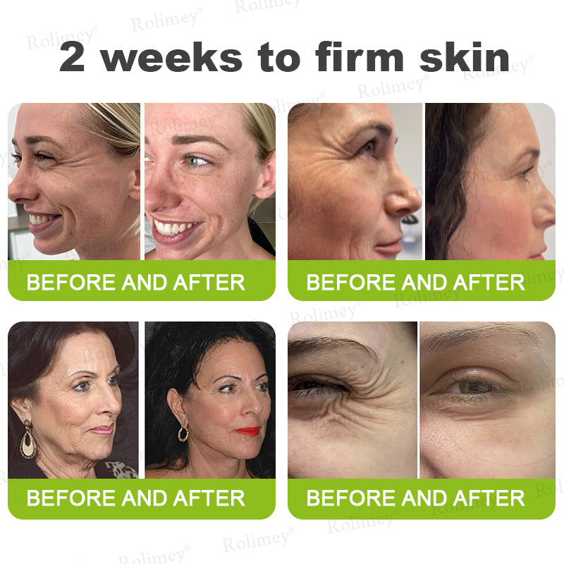 Rolimey® Botox & Vita-A Retinol Shot Wrinkle-Lift Tightening cream - Last Day Promotion 70% OFF