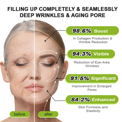 Rolimey® Botox & Vita-A Retinol Shot Wrinkle-Lift Tightening cream - Last Day Promotion 70% OFF