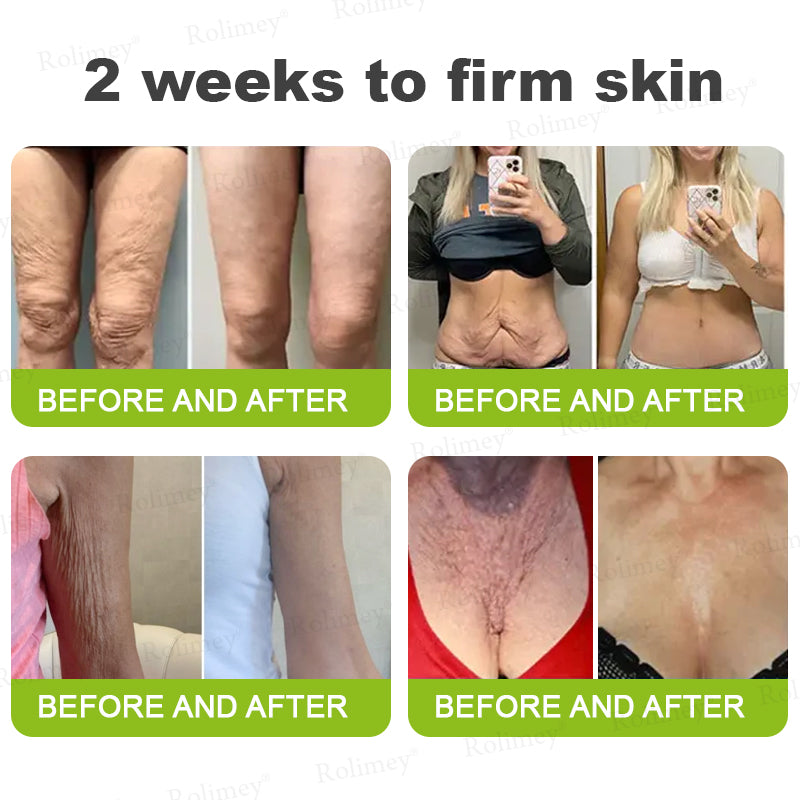 Rolimey® Botox & Vita-A Retinol Shot Wrinkle-Lift Tightening cream - Last Day Promotion 70% OFF