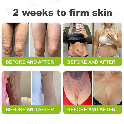 Rolimey® Botox & Vita-A Retinol Shot Wrinkle-Lift Tightening cream - Last Day Promotion 70% OFF
